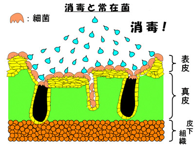 消毒と常在菌