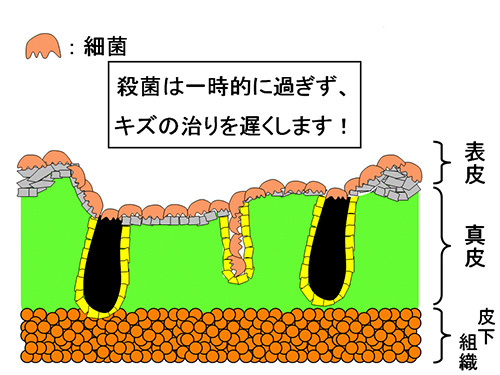 細菌は一時的に過ぎず、キズの治りを遅くします！