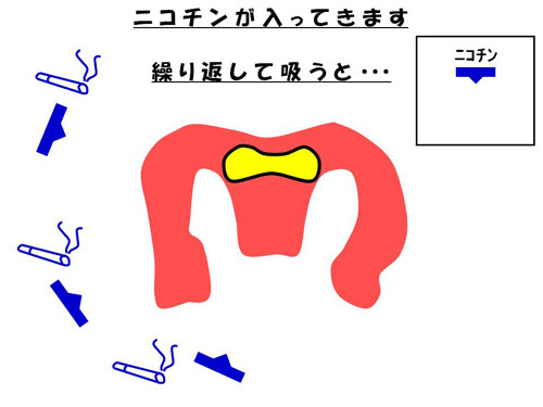 ニコチンが入ってきます　繰り返して吸うと…